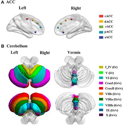 Altered Posterior Cerebellar Lobule Connectivity With Perigenual Anterior Cingulate Cortex in Women With Primary Dysmenorrhea